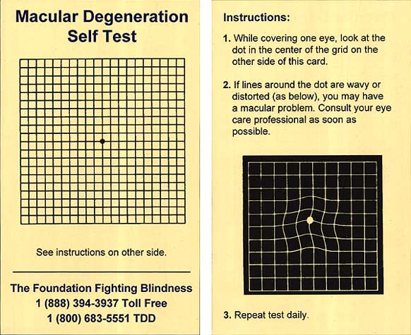 visiontest